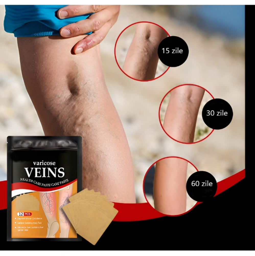 Set 24 Plasturi pentru varice si picioare grele Anti Varice